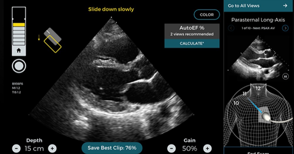 Caption Health running on tablet