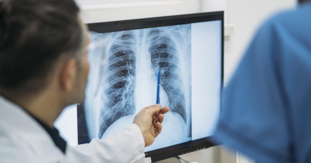 X-rays