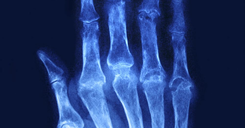 radiology image