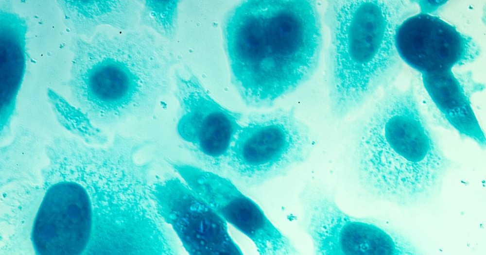 robots helping with inflammation