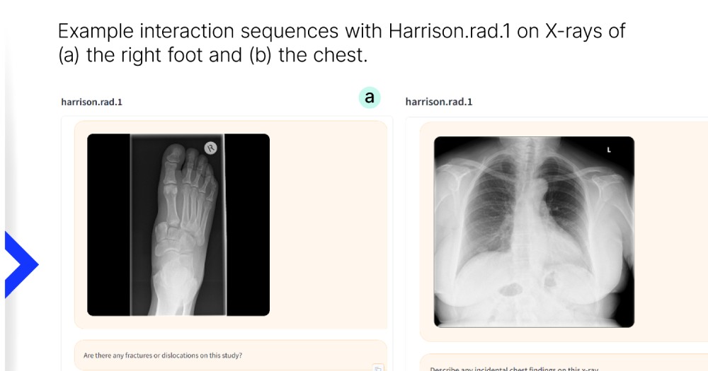 Harrison rad 1 Interaction graphic
