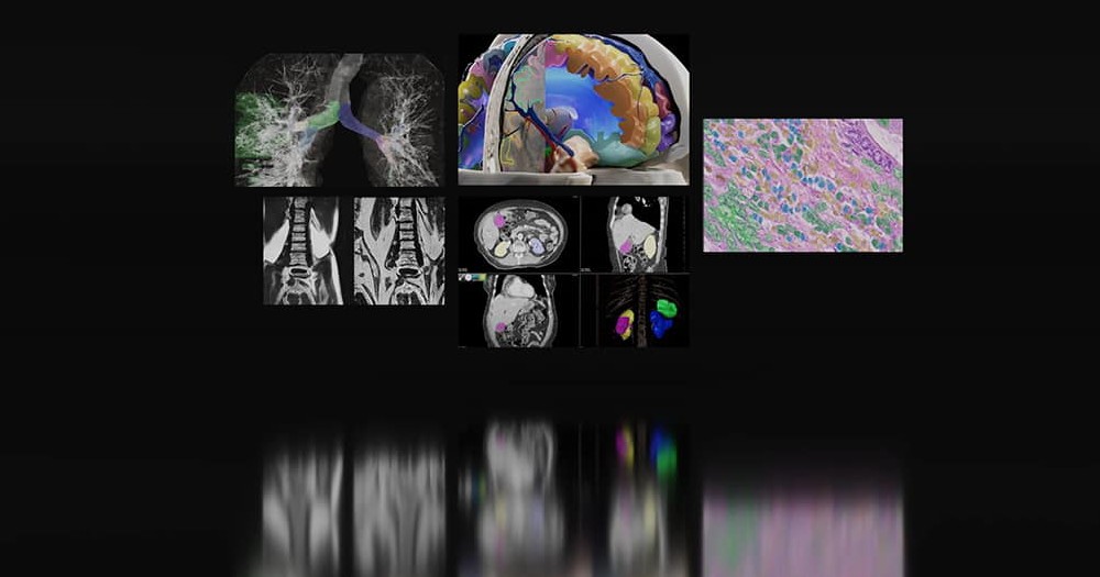 NVIDIA medical imaging tech