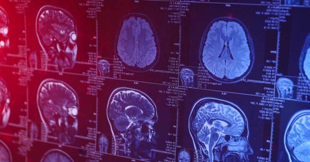 New algorithm promises to revolutionize cancer detection