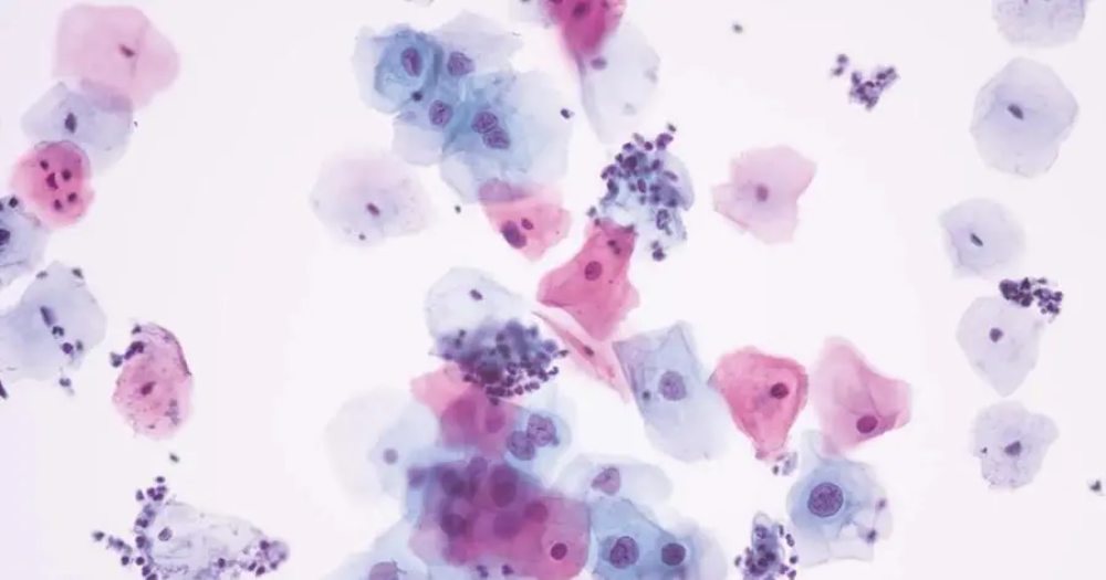 digital cytology technology