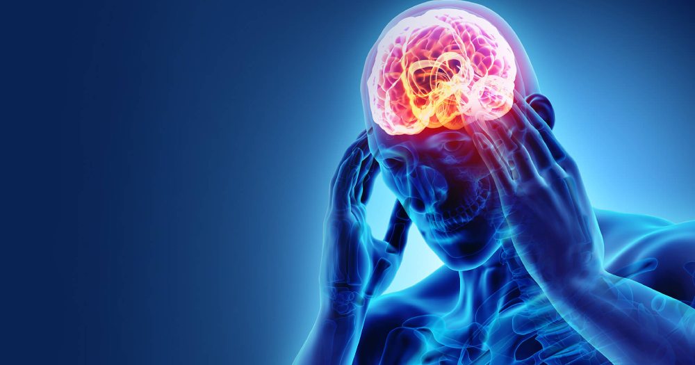 headache migraine