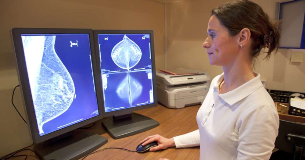 AI for early detection of interval breast cancers