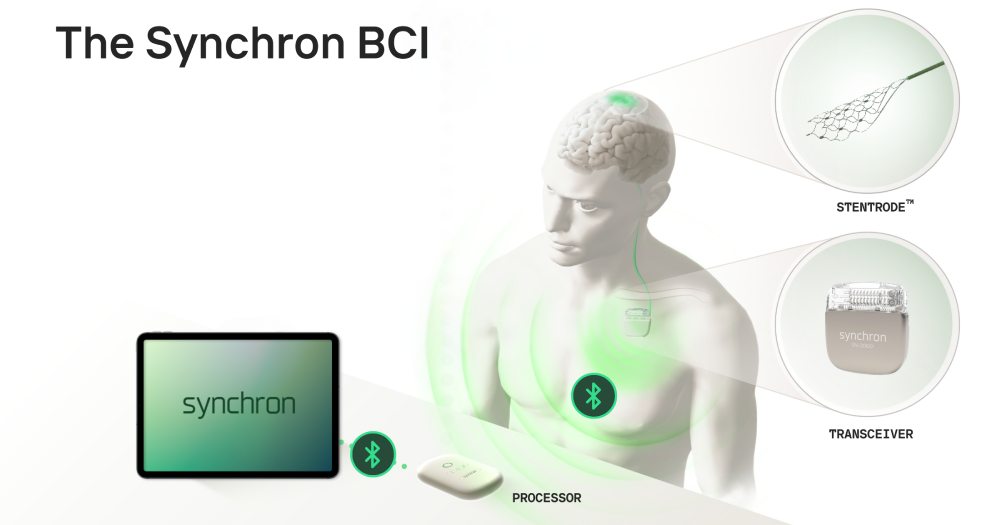 Synchron BCI System