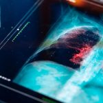 cancer detection with AI and robots