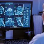 AI rewrites medical scan reports to make them readable for patients