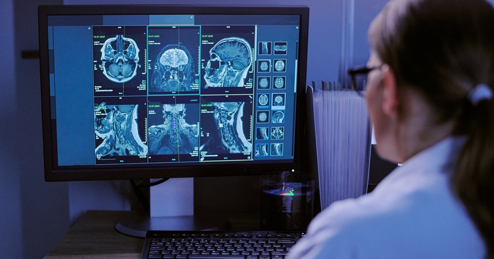 AI rewrites medical scan reports to make them readable for patients